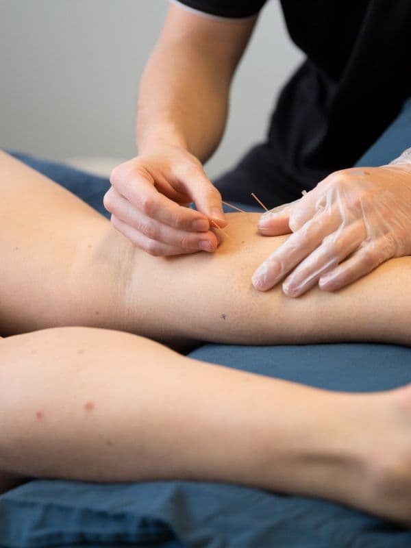 Physiotherapy